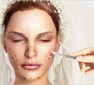 Dr. John Zannis&#39; Tips for Brides Considering Plastic Surgery | Arabia Weddings - bride_plastic_surgery